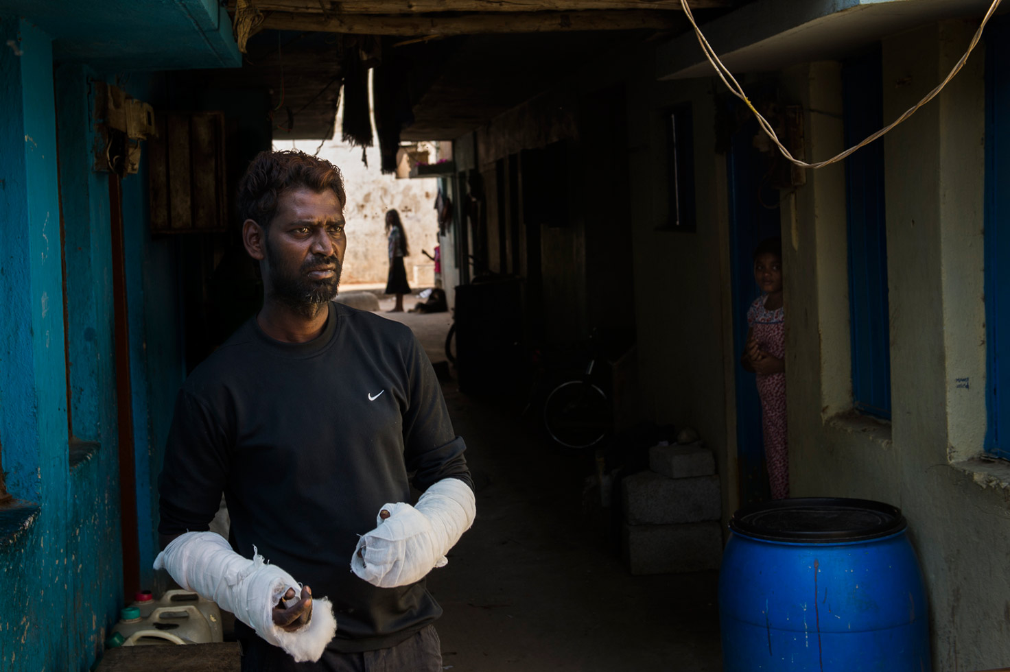 According to Gondo Raj, 35, he severely burned his hands while trying to save his wife Soya, mother of three, after she lit herself on fire. Soya's family accuses Gondo of murdering her.