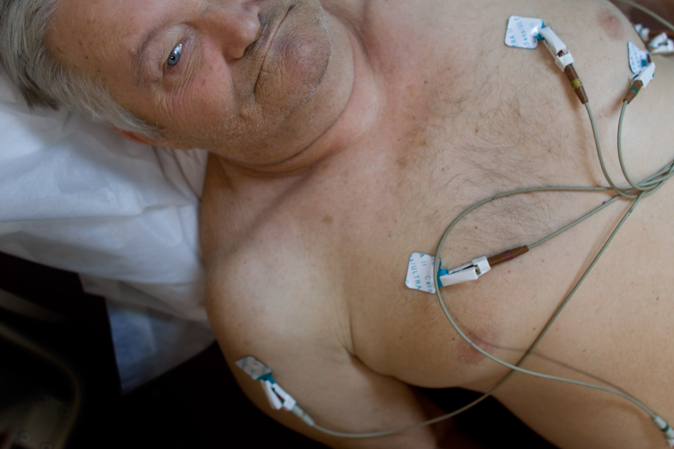 Otis Gillenwater from Sumarco was a miner for three decades. He is here at the Tug River black lung clinic, the only one in southern West Virginia, to find out if he qualifies for compensation from the coal company where he worked.