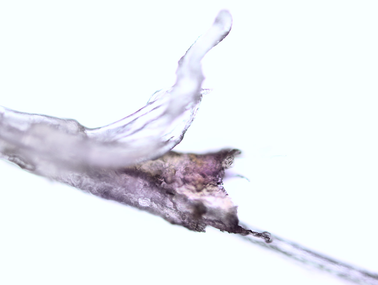 Hair Follicle, 100x